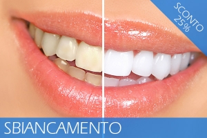 Offerta Sbiancamento - sconto 25%